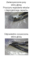 sHearts_Oczyszczenie porów.png